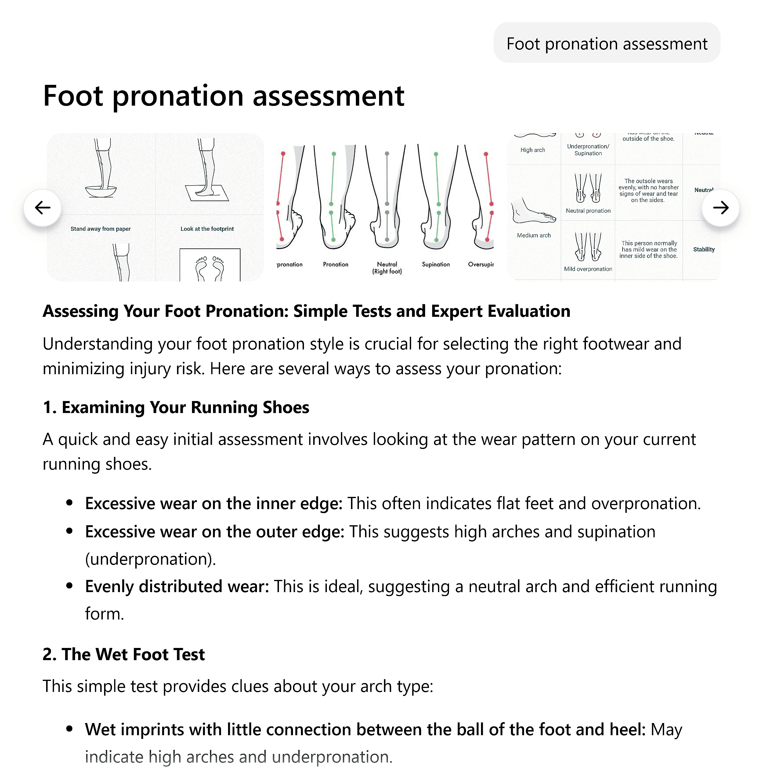 Sigma Chat – Foot pronation